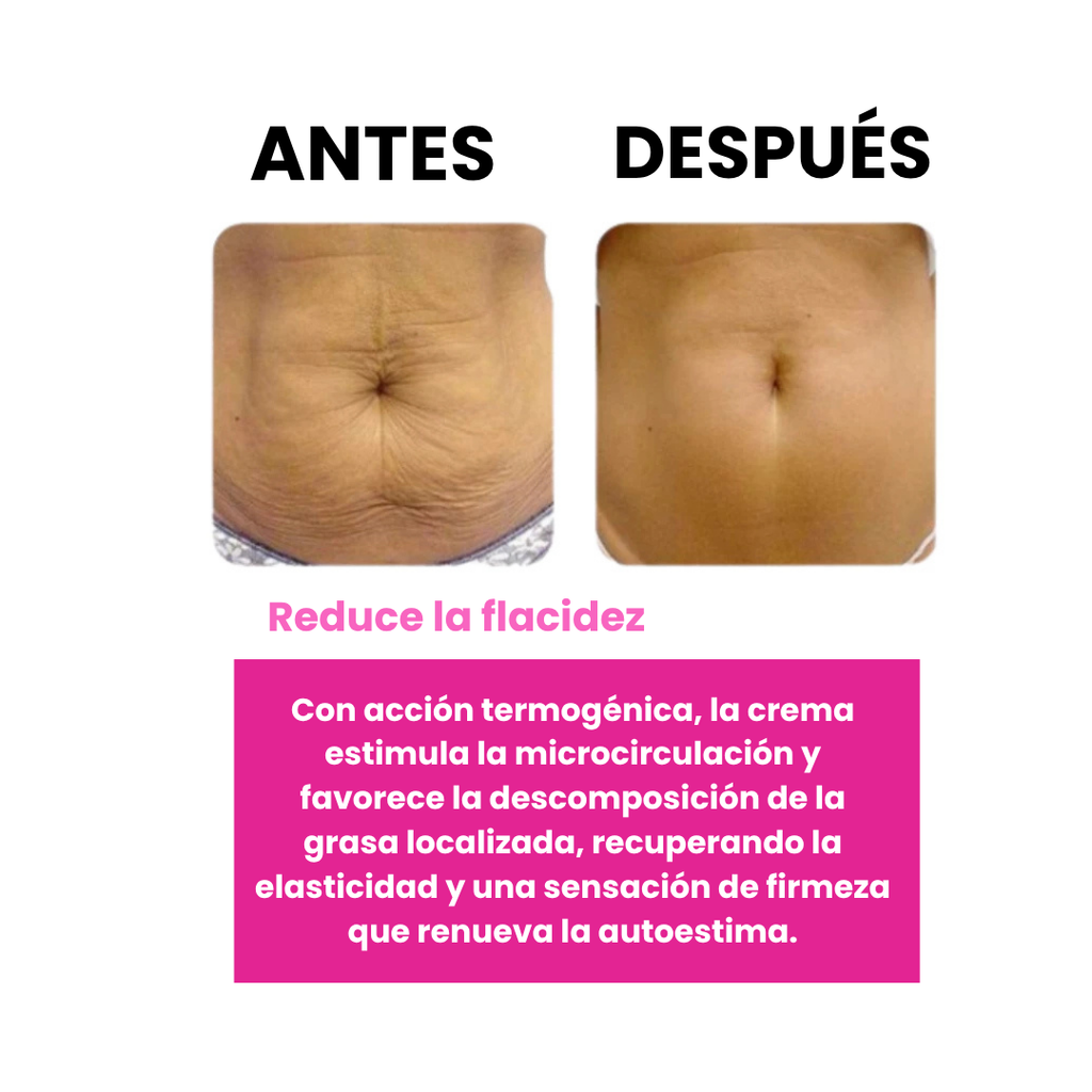 Adeus para Celulitis y Estrías 300ml